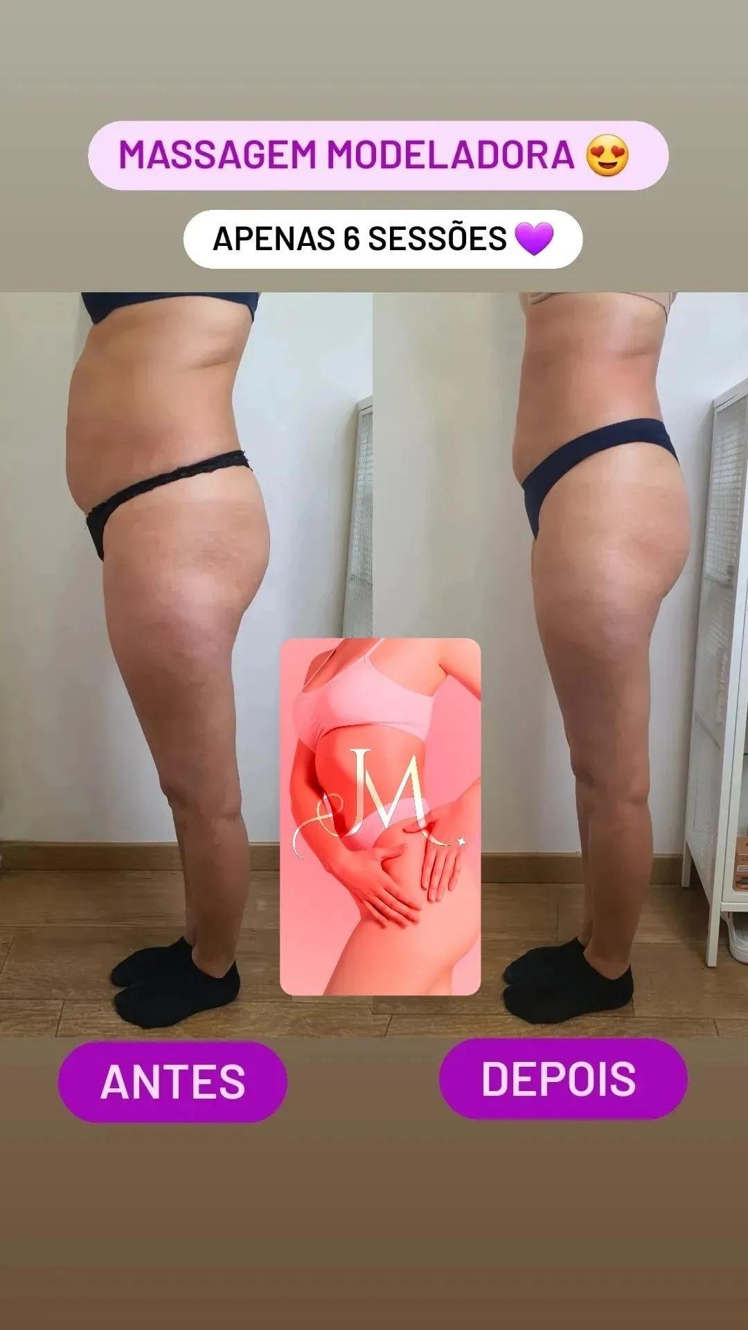 Massagem Modeladora Corporal — Resultado real de cliente · Atelier Janet Moreno, Carnaxide