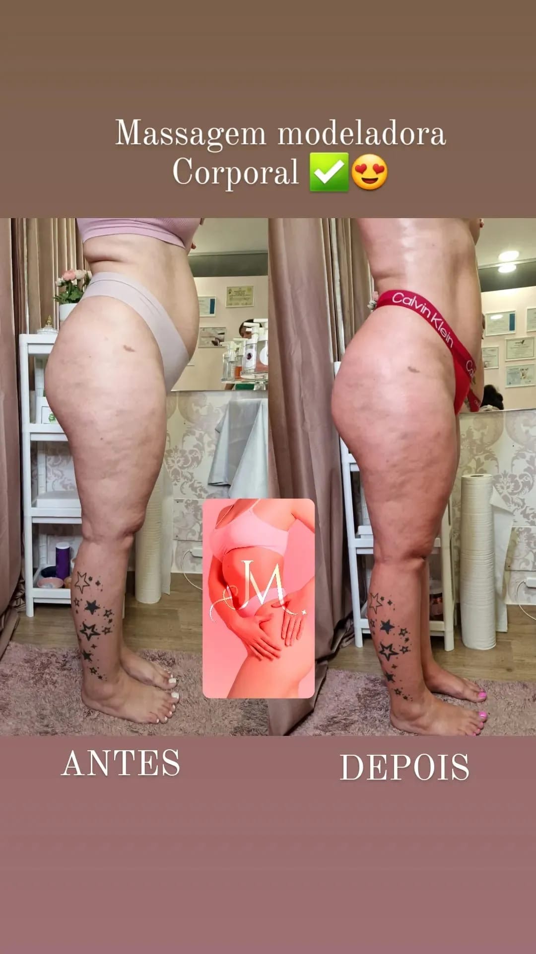 Massagem Modeladora Corporal — Resultado real de cliente · Atelier Janet Moreno, Carnaxide