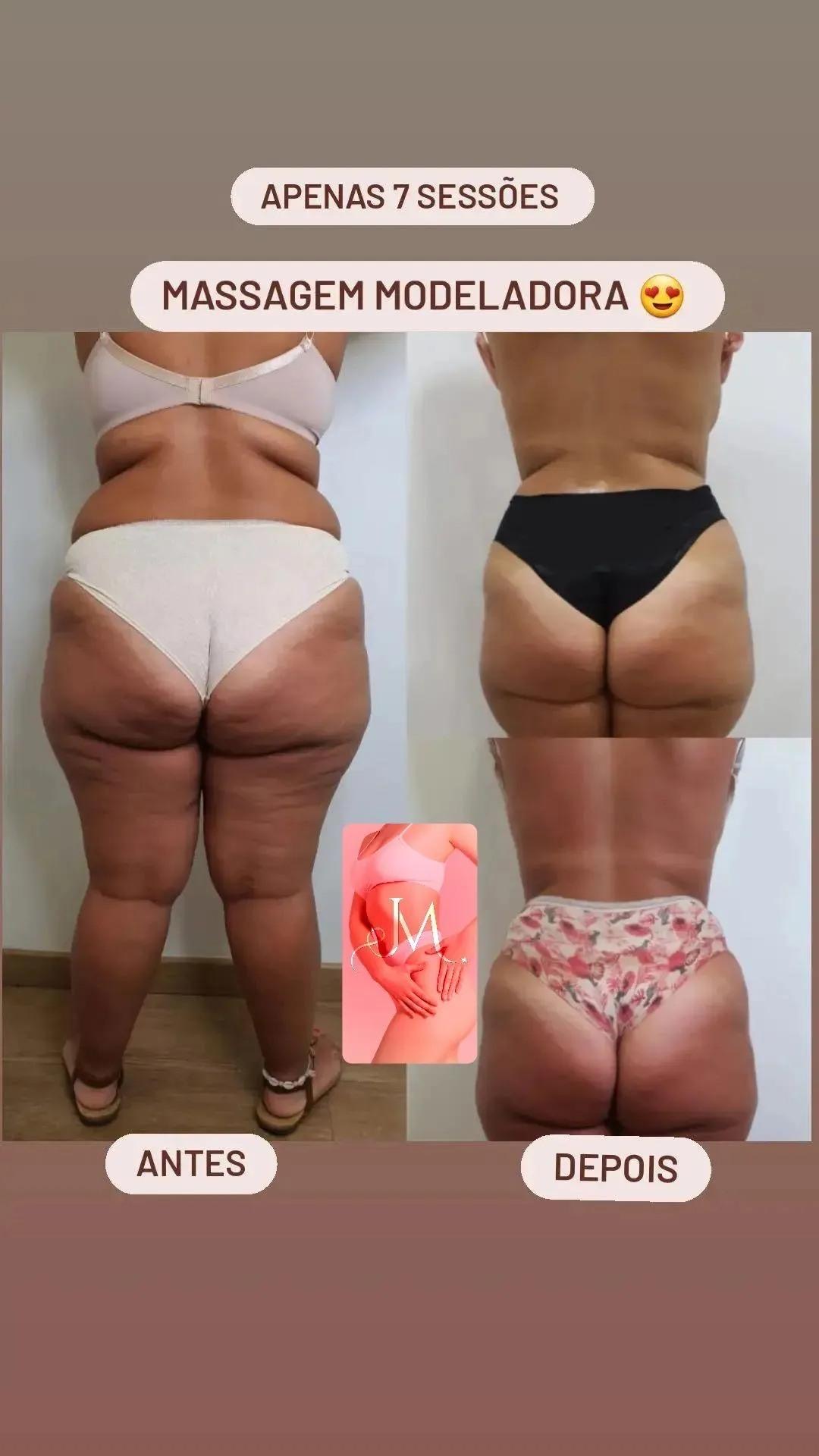 Massagem Modeladora Corporal — Resultado real de cliente · Atelier Janet Moreno, Carnaxide